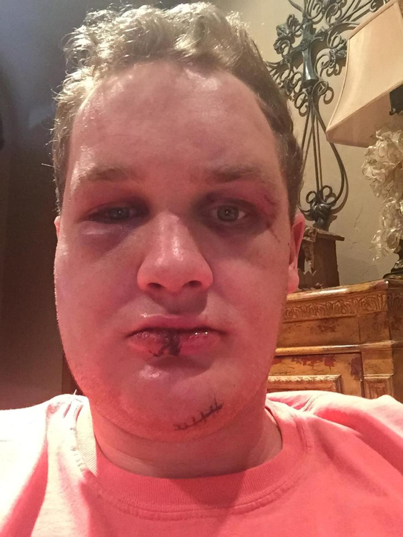 Illustration for article titled MLB Prospect's Lawyer Releases Graphic Photos After Alleged Assault